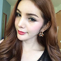 Nâng mũi hàn quốc