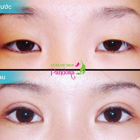 NHẤN MÍ HQ TIÊU CHUẨN
