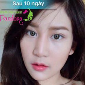 Tạo hình môi trái tim