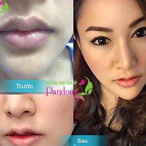 Tạo hình môi trái tim